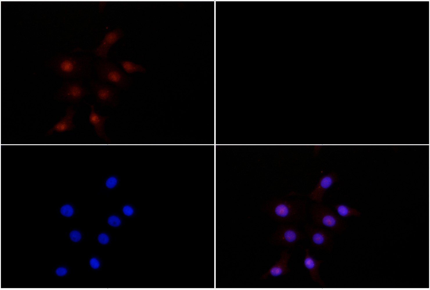 IKB-β (Y188) Polyclonal Antibody-Primary Antibodies-Bioworld Technology ...