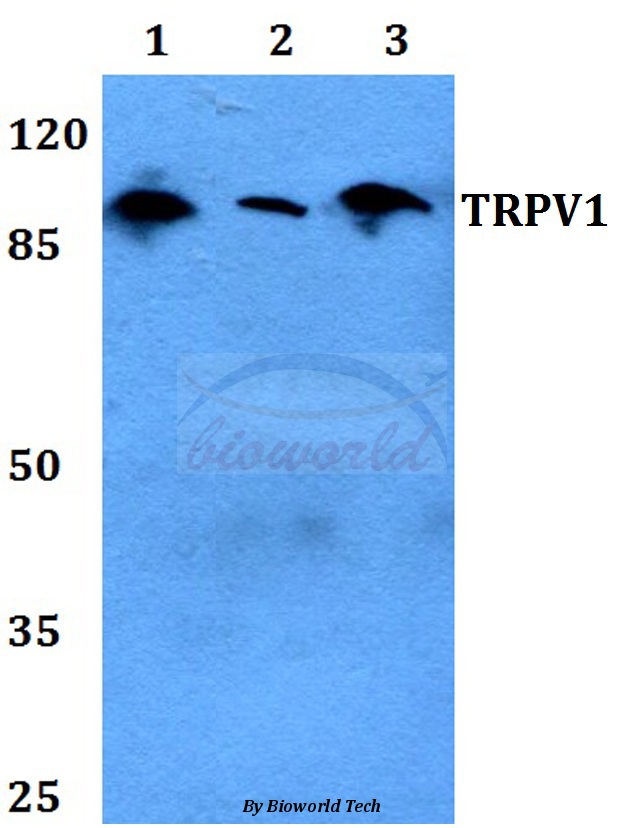 TRPV1 Polyclonal Antibody-Primary Antibodies-Bioworld Technology, Inc.