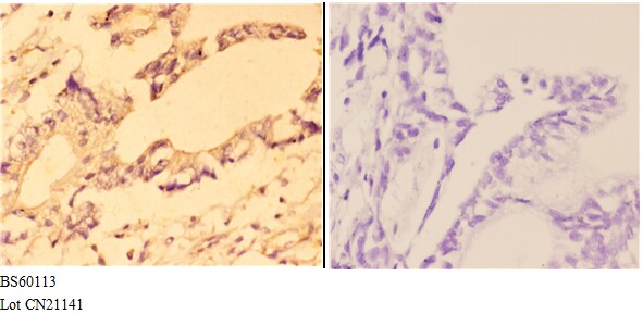 ABCC11 polyclonal antibody-Primary Antibodies-Bioworld Technology, Inc.