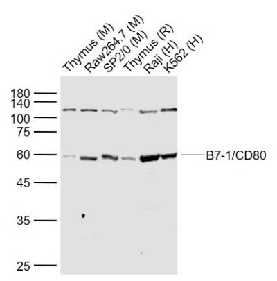 B7-1/CD80 polyclonal antibody-Primary Antibodies-Bioworld Technology, Inc.