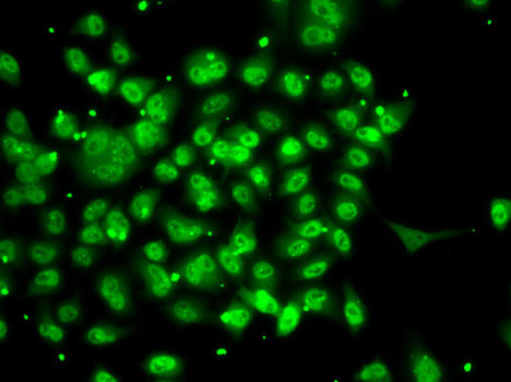 SMYD3 polyclonal antibody-Primary Antibodies-Bioworld Technology, Inc.