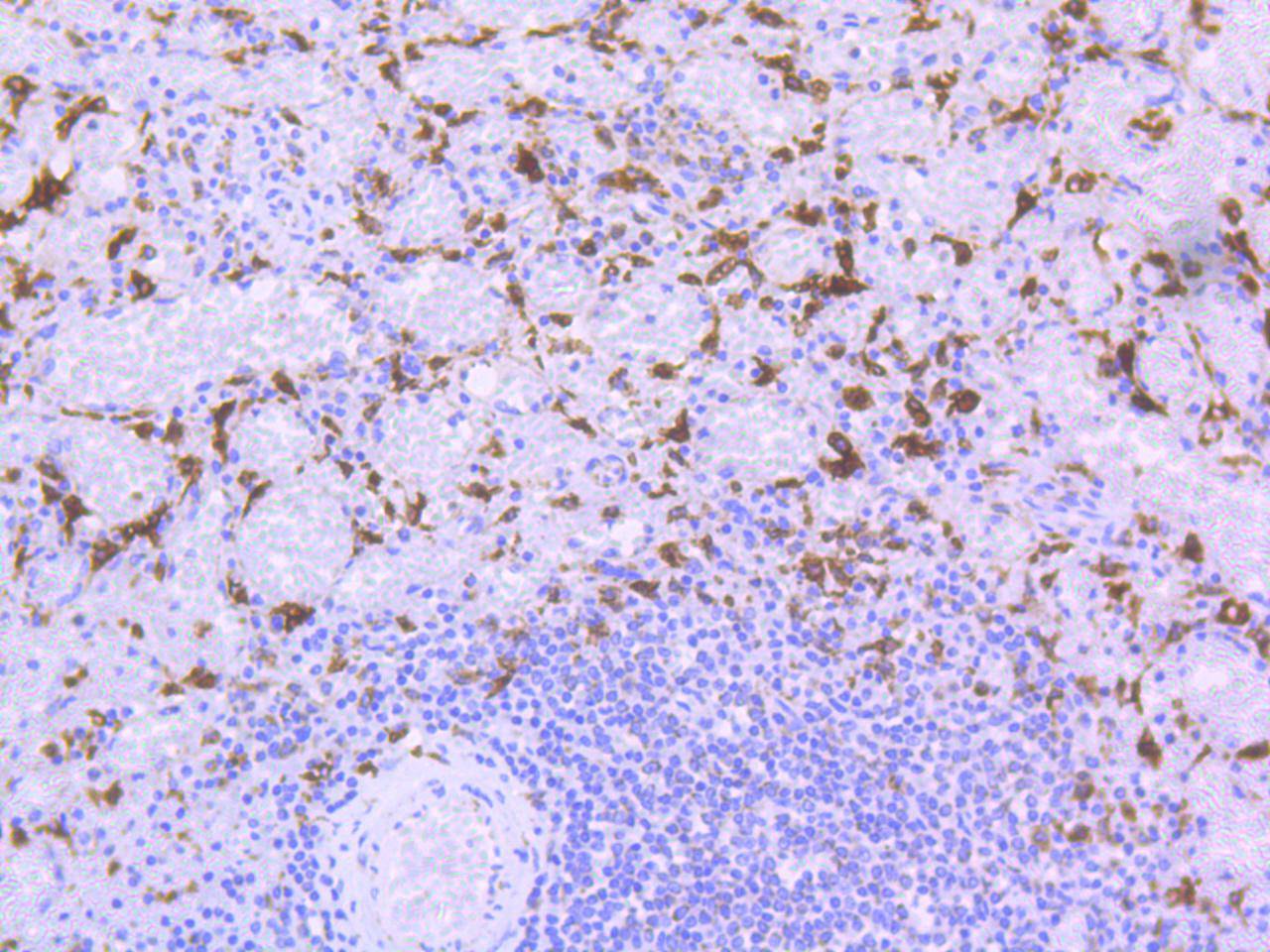 HO-1 polyclonal antibody-Primary Antibodies-Bioworld Technology, Inc.