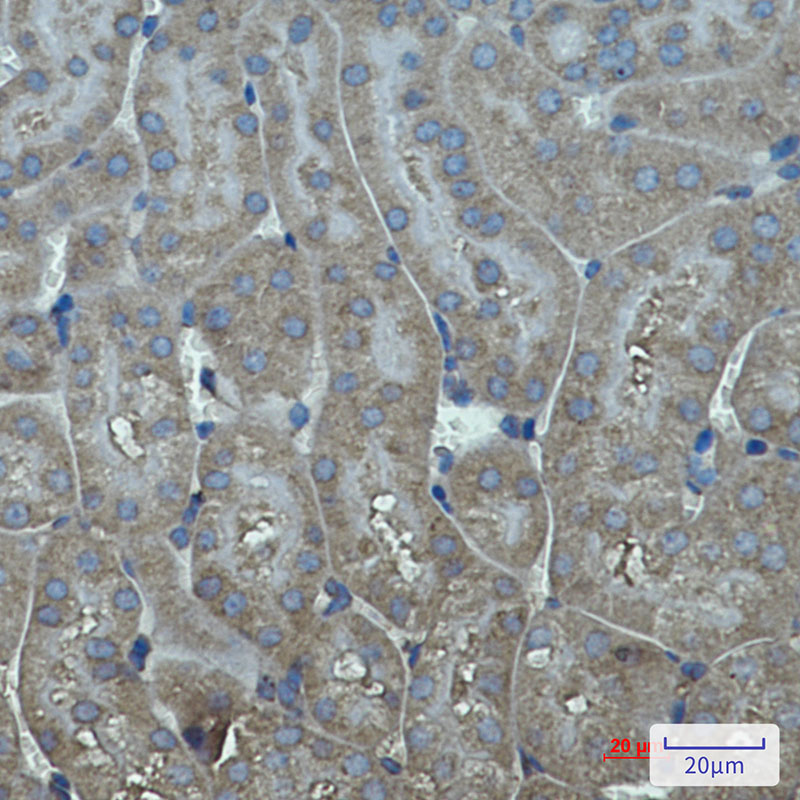 Cytochrome P450 17A1 monoclonal antibody-Primary Antibodies-Bioworld ...